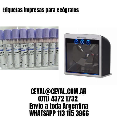 Etiquetas impresas para ecógrafos